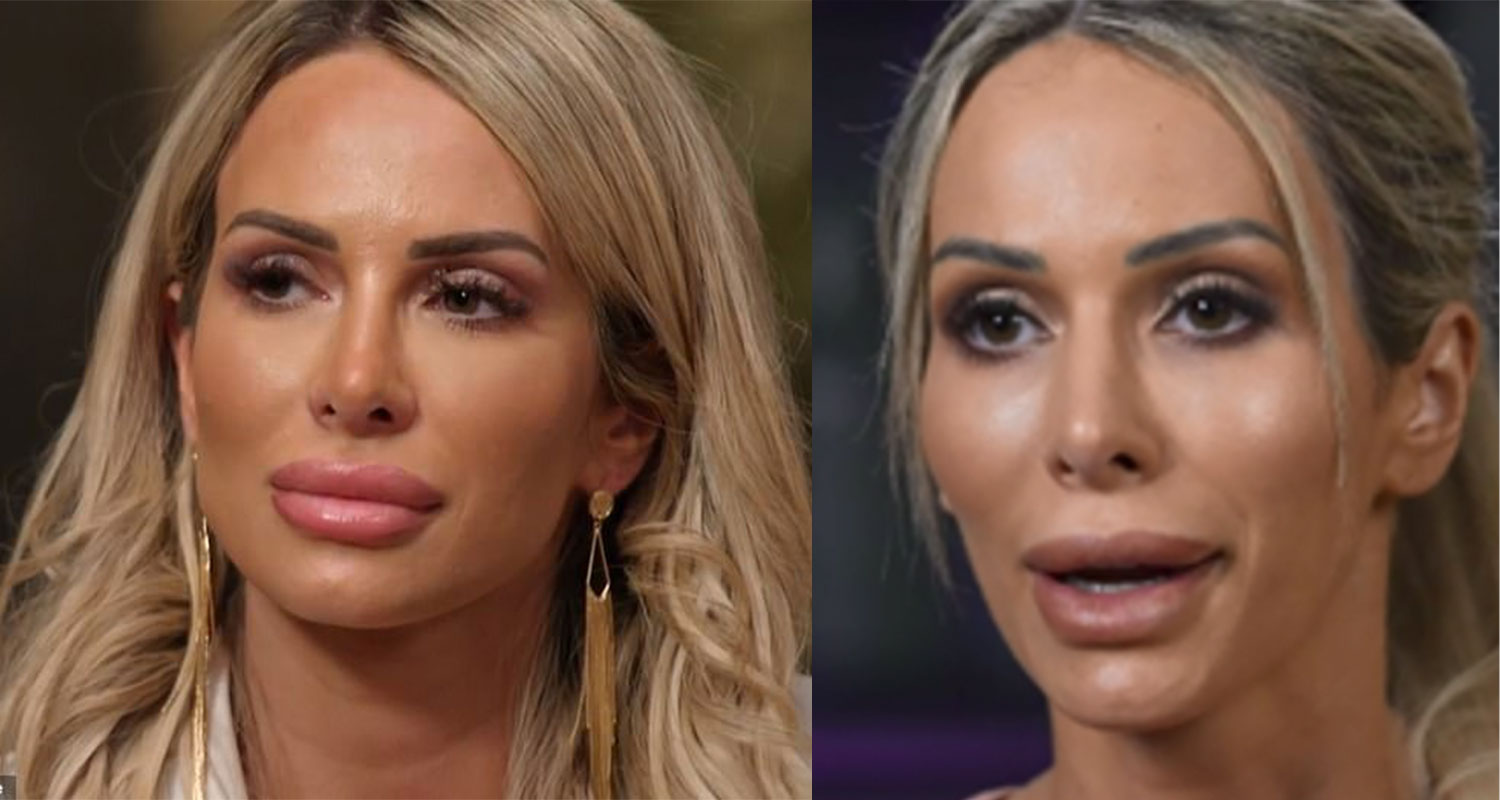 MAFS 2020: Stacey Hampton explains why her lips keep getting bigger each  episode | WHO